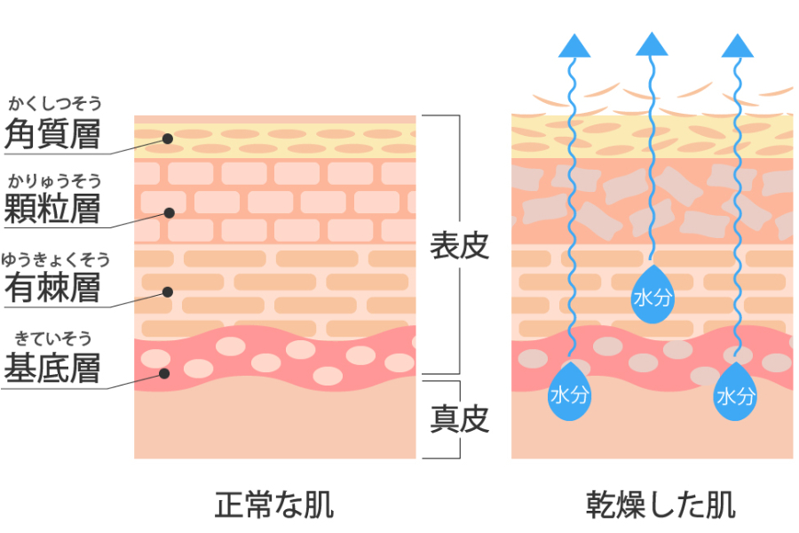 乾燥肌を1日で治すスキンケア