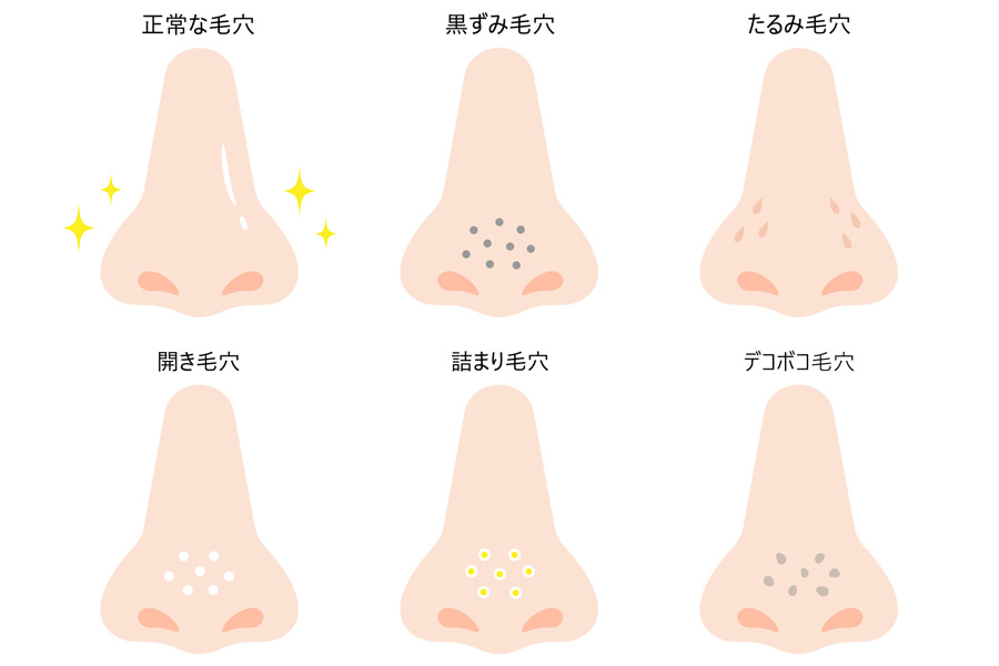 即効性抜群のスペシャルケアで毛穴をカバー