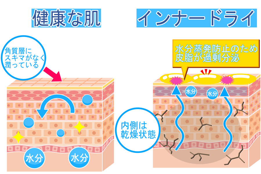 インナードライに気をつける