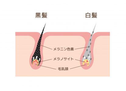 白髪のメカニズム""