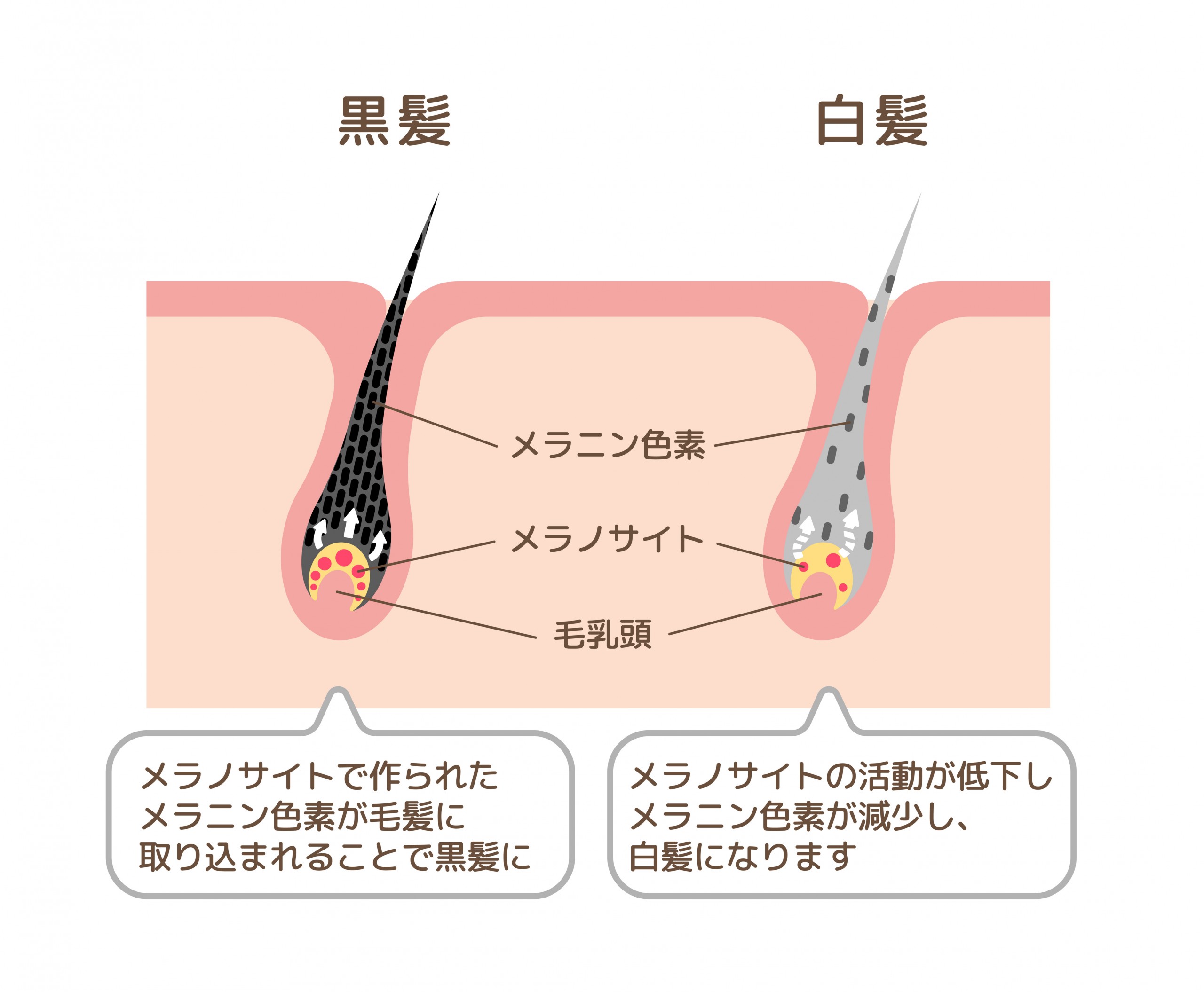 白髪がはえる原因