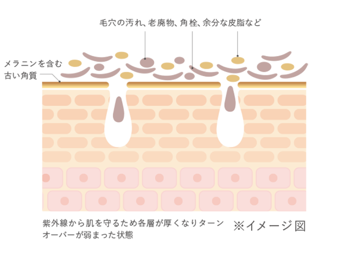 毛穴の汚れ、老廃物、 角栓、余分な皮脂など メラニンを含む 古い角質 紫外線から肌を守るため各層が厚くなりターンオーバー が弱まった状態。